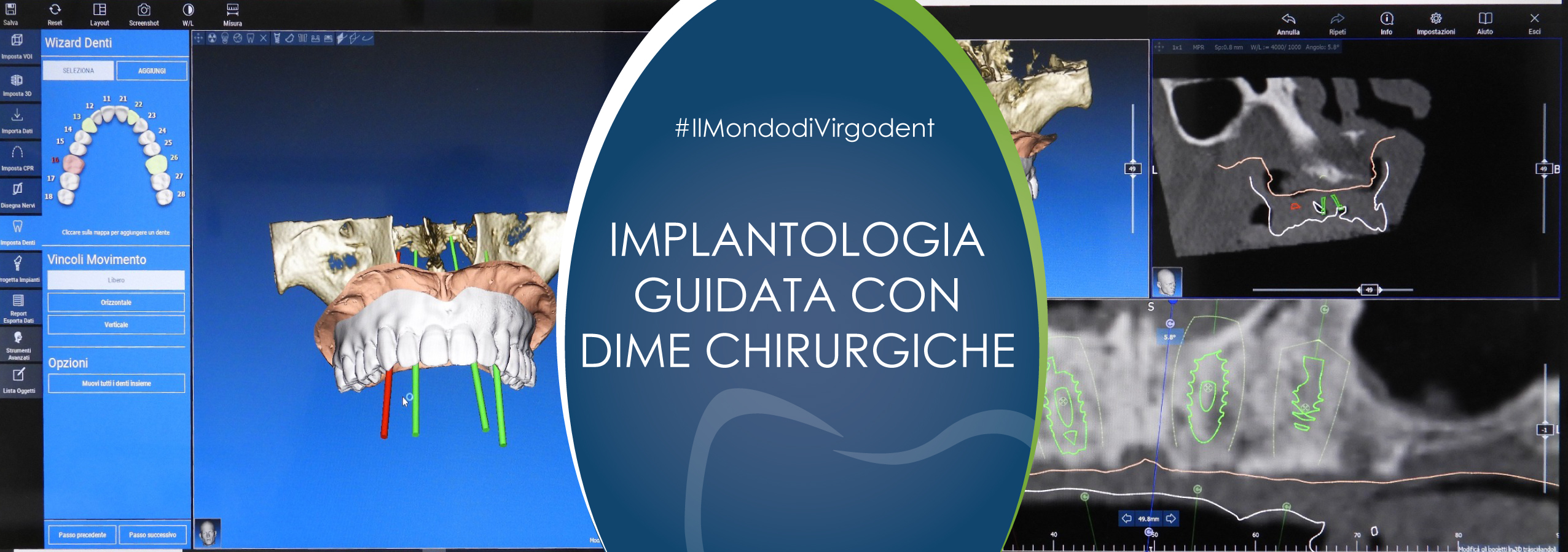 Slide 3